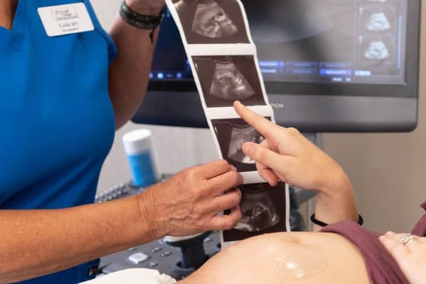 A woman seeing her ultrasound provided by ICU Mobile